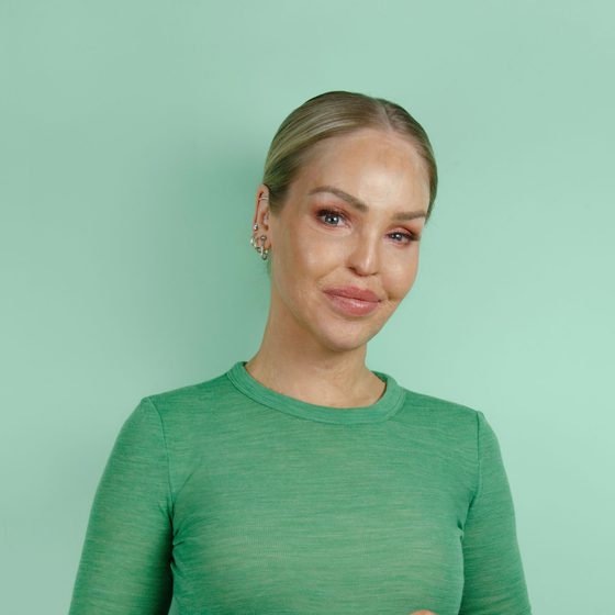 Katie Piper